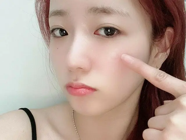 【G公式】Apink_Bomi，今天是麻烦事！ #Acropass #故障 #皮肤麻烦 #停止治疗 #晚安晚安🌙  