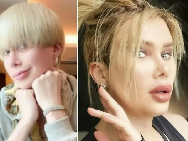 Oli London, a British man who had plastic surgery 18 times longing for JIMIN,reported that he had un