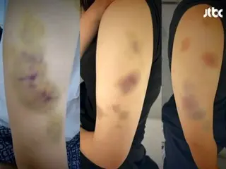 “她晕过去了我还继续打她”……跆拳道教练未经允许闯入女高中生宿舍，对她进行无差别殴打（韩国）