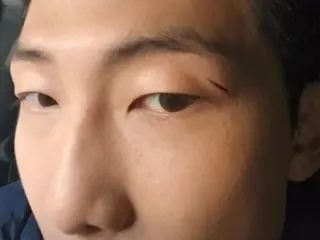 “BTS”RM英俊的脸上露出了深深的伤疤……眼睛上方有一道痛苦的伤疤