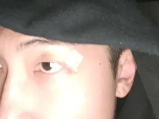 《BTS》RM，眼睛上方的伤疤还好吗？